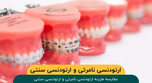 مقایسه-هزینه-ارتودنسی-نامرئی-ارتودنسی-سنتی